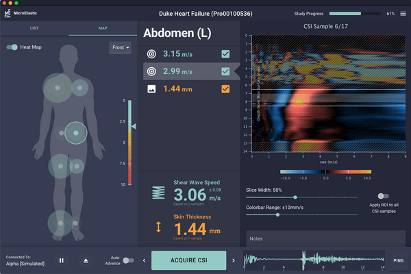 featured image thumbnail for post MicroElastic